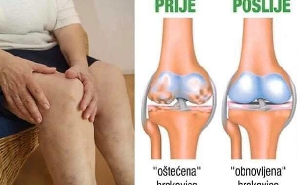 želatina za bolove u zglobovima koljena